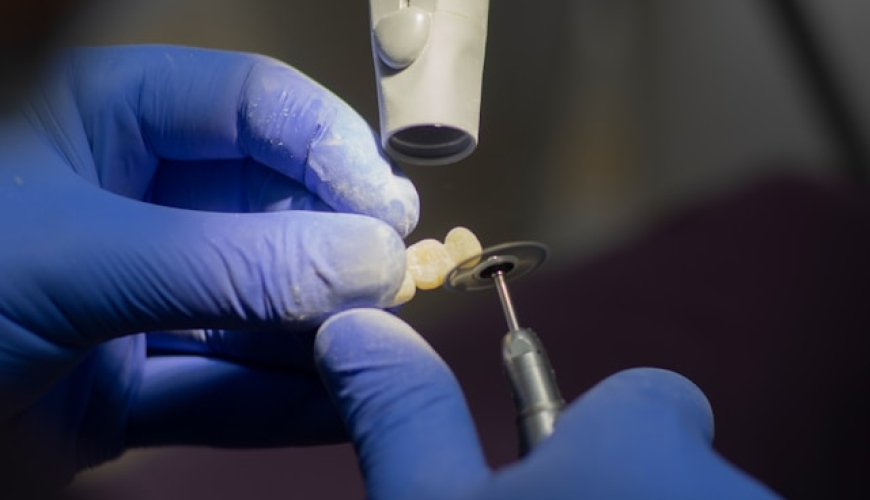 Endodonti Kanal Tedavisi Yapar Mı