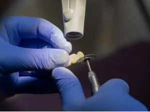 Endodonti Kanal Tedavisi Yapar Mı