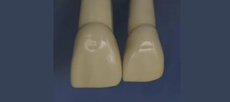 Sabundan Diş Yapımında Kullanılan Dental Malzemeler ve Üst Santral ve Lateral Diş Yapımı